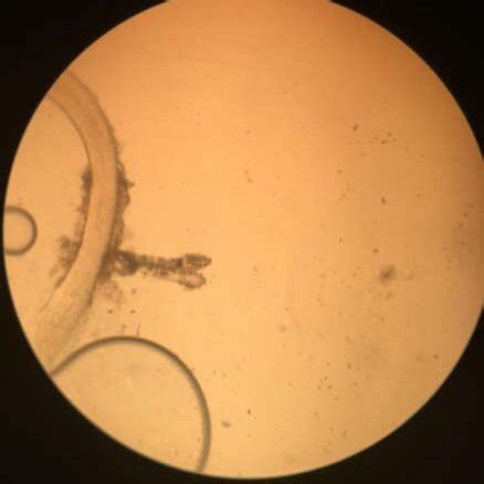 Demodex folliculorum (a) and D. brevis (b) under a light microscope ...