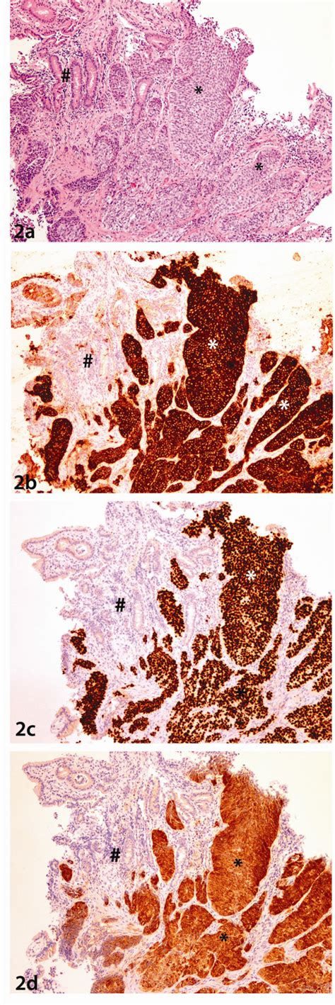 Duodenal Biopsy 2a Photomicrograph Of Haematoxylin And Eosin Stained Download Scientific