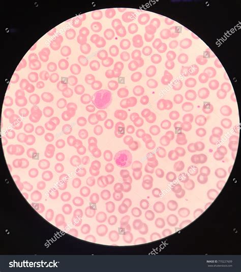 Monocyte Neutrophil On Blood Smear Stock Photo 770227609 Shutterstock