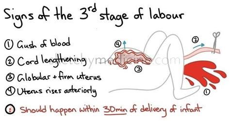 Signs Of The 3rd Stage Of Labour Stages Of Labor Nursing School