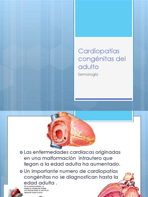 Cardiopatías Congénitas Del Adulto Defecto Cardíaco Congénito