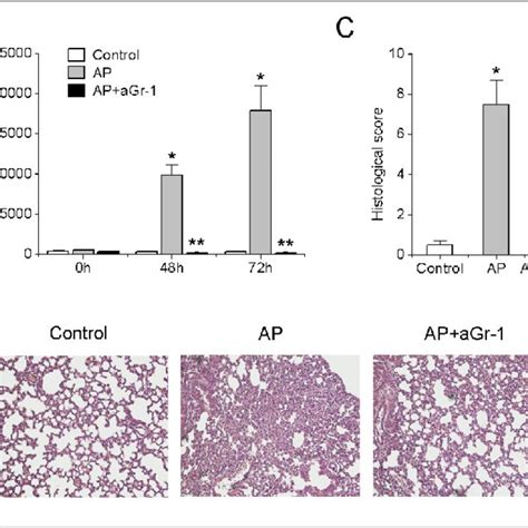 Neutrophils depletion leads to decreased plasma levels of TNF α IL 6