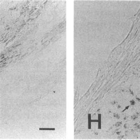 Photomicrographs Of Nadphd Histochemical Staining In Human Cerebral