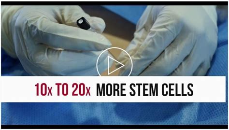 Stem Cell Disc Treatment