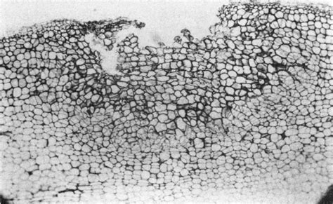 Transverse Section Through An Early Stage Of A Cavity Spot On A Carrot