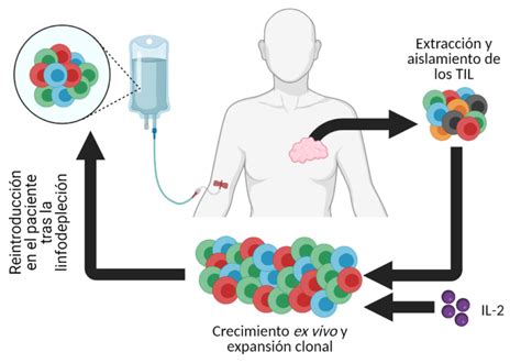 Inmunoterapia Celular Basada En La Transferencia De Linfocitos T Ceebi