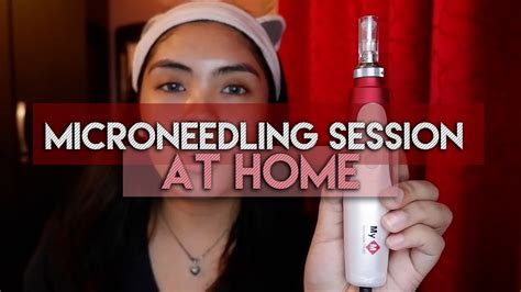 Microneedling Therapy At Home My M Derma Pen Tutorial Fabb Lagas