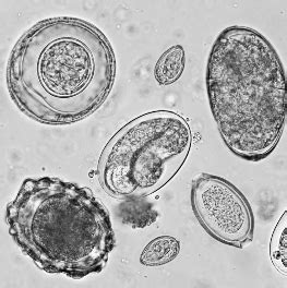 Parasites In Stool Microscope