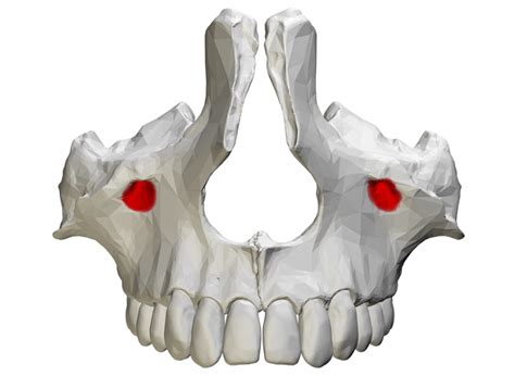 Maxillary Bone