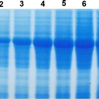 SDS PAGE Analysis Of 6xHis Gklip In E Coli BL 21 DE3 M Protein