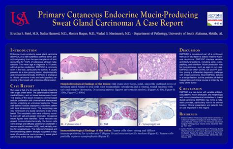 PDF Primary Cutaneous Endocrine Mucin Producing Sweat Gland Carcinoma