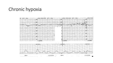 Baby's heart rate | PPTX