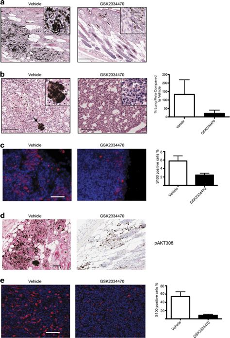 Pdk1 Inhibitor Gsk2334470 Delays Melanoma Formation And Inhibits