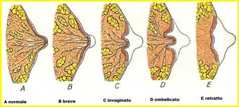 Mammella Anatomia Chirurgica FertilityCenter