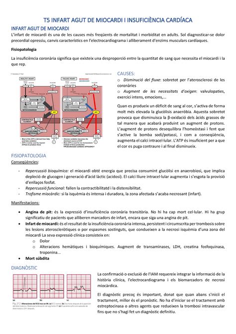 Bloc 2 T5 Infart Agut De Miocardi T 5 Infart Agut De Miocardi I