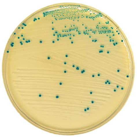 Strepto B Chromogenic Agar Lickson