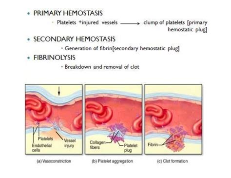 Diagram Of Platelet Plug Formation Platelet Plug Formation