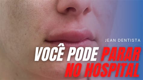 Rosto Inchado Dente Infeccionado Porque T O Perigoso Youtube