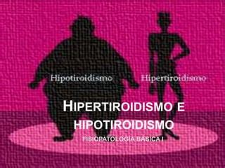 Hipertiroidismo E Hipotiroidismo Ppt