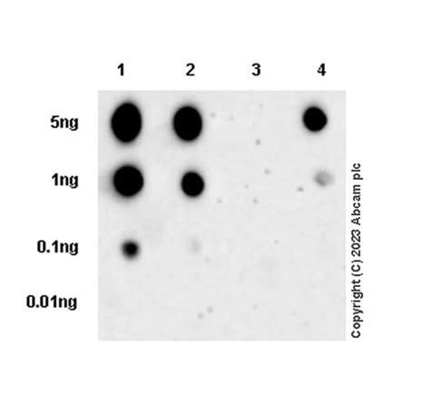 Recombinant Anti Aldolase A B C Lactyl K147 Antibody EPR24696 317