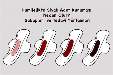 Hamileliğin ilk haftalarında görülen siyah adet kanaması kahverengi ve