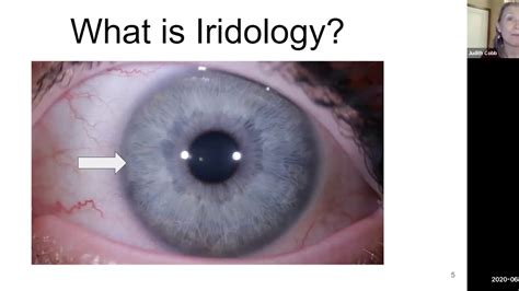 Introduction To Constitutional Iridology Youtube