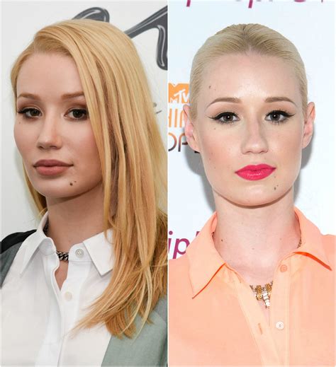 Iggy Azalea to Hollywood: Stop Calling Plastic Surgery ‘Contouring ...