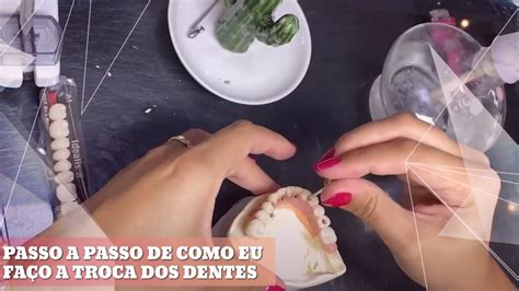 PASSO A PASSO DE COMO EU FAÇO A TROCA DE DENTES Beatriz Vieira YouTube