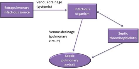 Associations And Outcomes Of Septic Pulmonary Embolism Pmc