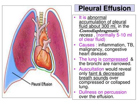 PPT - Pleura and Lung PowerPoint Presentation - ID:2308086