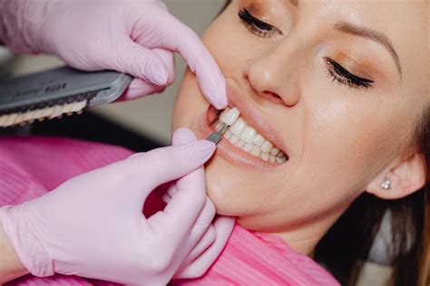 How Much Are Veneers A Comprehensive Guide To Veneer Costs Best