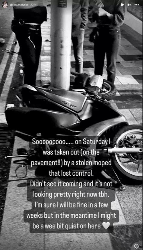 A Place In The Sun S Danni Menzies Hides Scar As She Poses In Lingerie After Moped Crash Irish