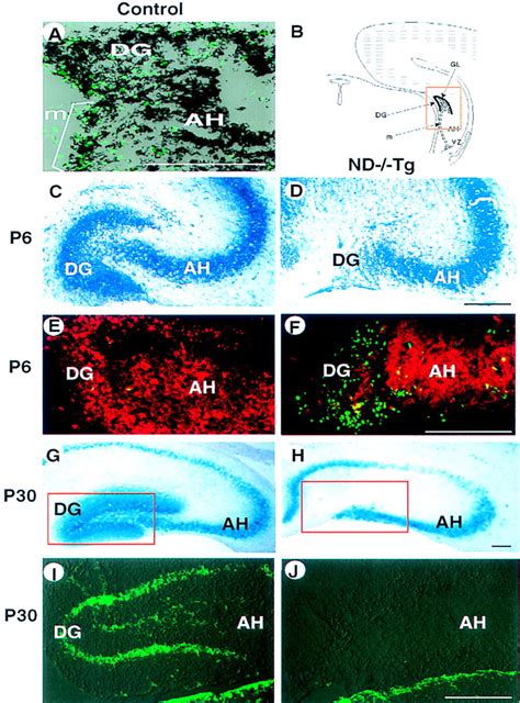 NeuroD Is Required For Differentiation Of The Granule Cells In The