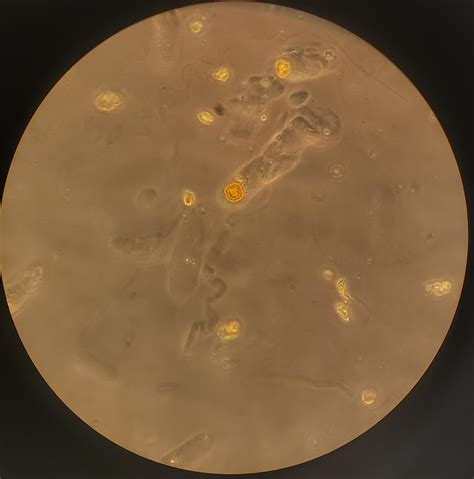 My first Leucine crystal : r/medlabprofessionals