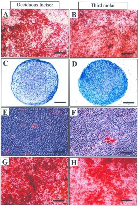 Differentiation of human dental pulp stem cells: either cell was ...