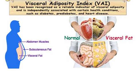 Visceral Adiposity Index Vai Visceral Adiposity Index Calculator