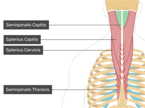 Cervical Spine Pathology Flashcards Quizlet