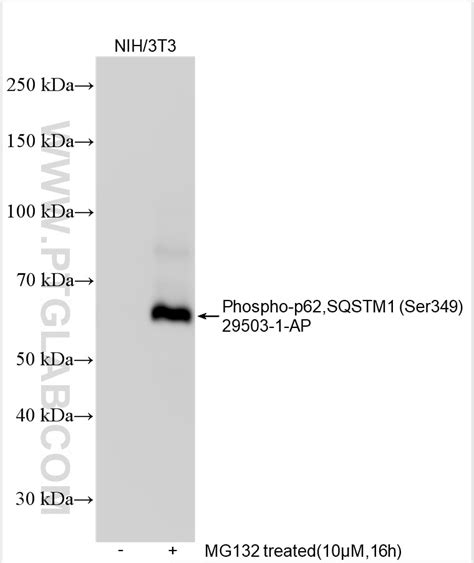 Phospho P62sqstm1 Ser349 Antibody 29503 1 Ap Proteintech