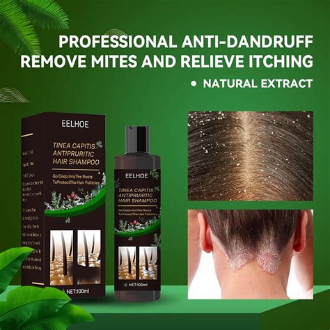 Ringshlar Professional Antidandruff Shampoo For Tinea Capitis 100ml Relieves Itching And