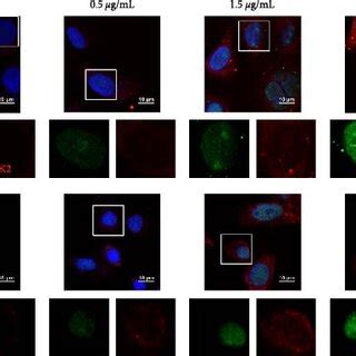 LDL Treatment Promoted EC Cell Proliferation Migration And Invasion