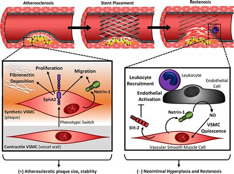 Frontiers Guidance Molecules In Vascular Smooth Muscle