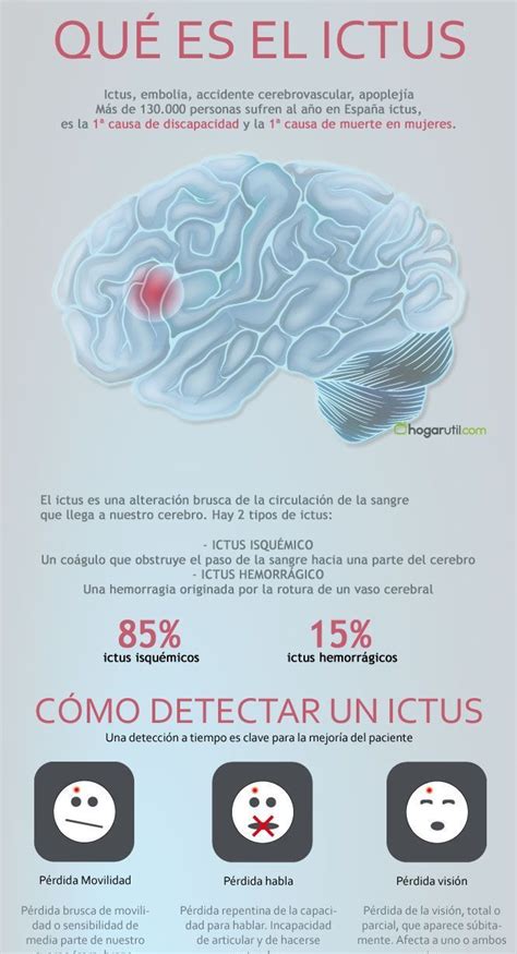 El Ictus Cerebral S Ntomas Y Prevenci N Infograf As Y Remedios