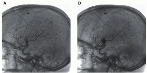 Fluoroscopy Radiology Key