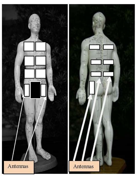 Wearable Antennas For Medical Applications Intechopen