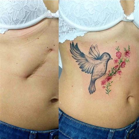 Tatuagem Para Cobrir Cicatriz Fotos Inspiradoras Amo Tatuagem