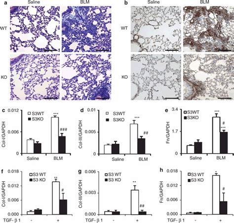 Smad3 knockout (KO) mice are protected against pulmonary fibrosis in... | Download Scientific ...