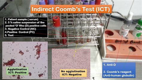 Indirect Coomb Test Ict Introduction Principle Procedure Result