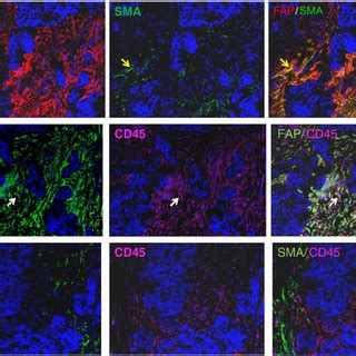 Evaluation Of Epcam Epithelial Cell Marker Fap And Sma Expression