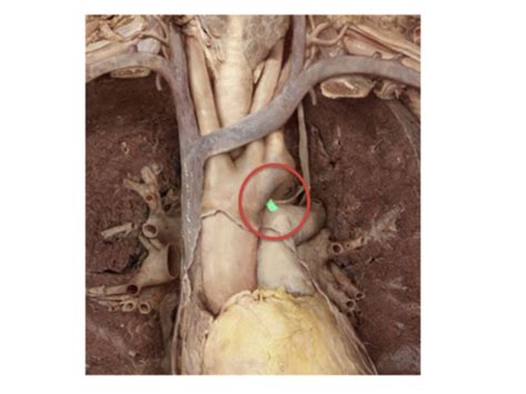 Special Pop Peds Cardiology Flashcards Quizlet