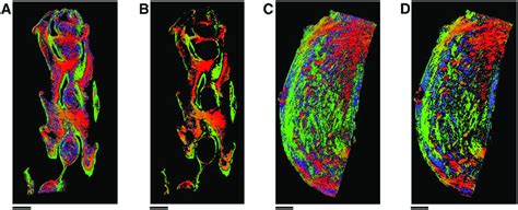 Isolating Myometrial Smooth Muscle The Combined Effect Of Bundle